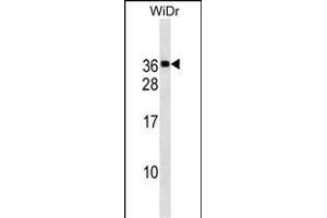 MED30 Antibody (Center) (ABIN1537737 and ABIN2838170) western blot analysis in WiDr cell line lysates (35 μg/lane). (MED30 antibody  (AA 107-133))