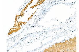 ABIN6260382 and ABIN6279246 at 1/100 staining Rat skin tissue by IHC-P.
