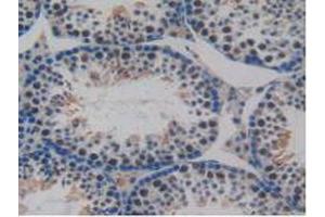 IHC-P analysis of Mouse Testis Tissue, with DAB staining. (CCL8 antibody  (AA 20-94))