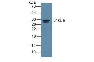 Western blot analysis of recombinant Human CA2. (CA2 antibody)