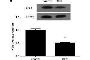 Down-regulation of Srx-1 in H9c2 cardiomyocytes under SI/R treatmentThe H9c2 cells were exposed to hypoxia for 10 h and then reoxygenated for 3 h. (Sulfiredoxin 1 antibody  (AA 45-137))