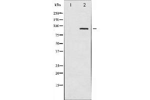 Western blot analysis of ADD1 expression in Forskolin treated HeLa whole cell lysates,The lane on the left is treated with the antigen-specific peptide.