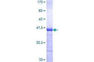 GGCX Protein (AA 533-629) (GST tag)