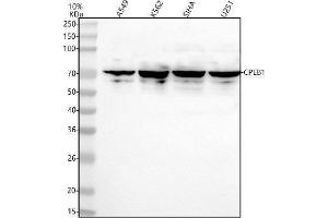 Western blot analysis of CPEB1 using anti-CPEB1 antibody (ABIN7604489).
