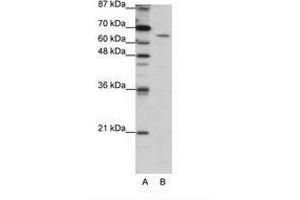 Image no. 2 for anti-Staufen Double-Stranded RNA Binding Protein 1 (STAU1) (AA 131-180) antibody (ABIN203214) (STAU1/Staufen antibody  (AA 131-180))
