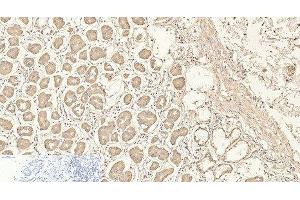 Immunohistochemistry of paraffin-embedded Human stomach tissue using CD4 Monoclonal Antibody at dilution of 1:200. (CD4 antibody)