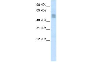 WB Suggested Anti-LMX1B Antibody Titration:  2. (LMX1B antibody  (C-Term))