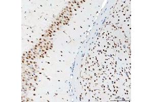 IHC analysis of DDX1 using anti-DDX1 antibody (ABIN7602050). (DDX1 antibody  (AA 562-740))