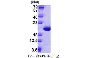 SDS-PAGE (SDS) image for Tubulin Polymerization-Promoting Protein Family Member 3 (TPPP3) (AA 1-176) protein (His tag) (ABIN5853114)