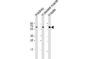 All lanes : Anti-DMRT2 Antibody (Center) at 1:2000 dilution Lane 1: human kidney lysate Lane 2: human skeletal muscle lysate Lane 3: human testis lysate Lysates/proteins at 20 μg per lane. (DMRT2 antibody  (AA 357-392))