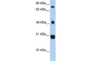 WB Suggested Anti-FIBCD1 Antibody Titration:  0. (FIBCD1 antibody  (C-Term))