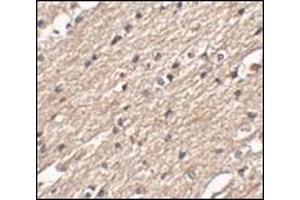 Immunohistochemistry of Spred3 in human brain tissue with this product at 2. (SPRED3 antibody  (Center))