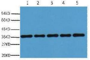 Western Blotting (WB) image for anti-Glyceraldehyde-3-Phosphate Dehydrogenase (GAPDH) antibody (ABIN3178741) (GAPDH antibody)