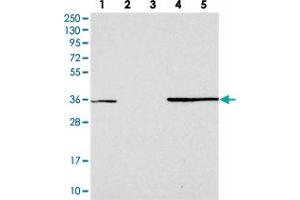 Western blot analysis of Lane 1: RT-4, Lane 2: U-251 MG, Lane 3: Human Plasma, Lane 4: Liver, Lane 5: Tonsil with FAM98C polyclonal antibody  at 1:250-1:500 dilution. (FAM98C antibody)