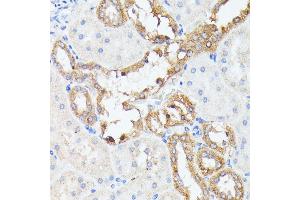 Immunohistochemistry of paraffin-embedded rat kidney using PTP4 antibody (ABIN7269703) at dilution of 1:100 (40x lens). (PTP4A2 antibody  (AA 30-100))
