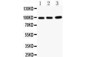 Western Blotting (WB) image for anti-erythrocyte Membrane Protein Band 4.1-Like 1 (EPB41L1) (AA 691-881) antibody (ABIN3042373)