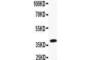 Anti- Furin Picoband antibody, Western blotting All lanes: Anti Furin  at 0. (FURIN antibody  (AA 591-794))