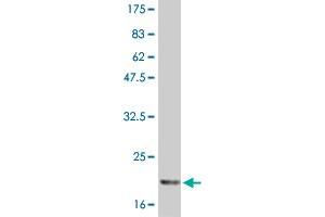 Western Blot detection against Immunogen (21 KDa) . (IL-6 antibody  (AA 29-212))