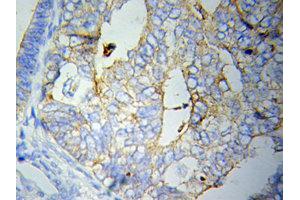 Immunohistochemistry (IHC) image for anti-C-Reactive Protein (CRP) (AA 1-224) antibody (ABIN3020716)