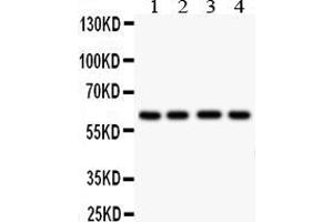Anti- HEXA antibody, Western blottingAll lanes: Anti HEXA  at 0.