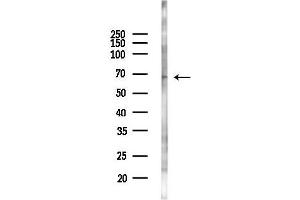 Western blot analysis of lysates from K562 cells(UV 30 min treatment), using OPRM1 Antibody at 1/1000 dilution.