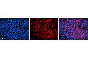 Rabbit Anti-PGRC2 Antibody   Formalin Fixed Paraffin Embedded Tissue: Human Testis Tissue Observed Staining: Plasma membrane in spermatozoa Primary Antibody Concentration: 1:100 Other Working Concentrations: 1:600 Secondary Antibody: Donkey anti-Rabbit-Cy3 Secondary Antibody Concentration: 1:200 Magnification: 20X Exposure Time: 0. (PGRMC1 antibody  (C-Term))