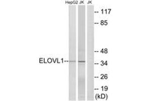 Western blot analysis of extracts from Jurkat/HepG2 cells, using ELOVL1 Antibody.
