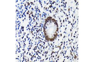 Immunohistochemistry of paraffin-embedded human appendix using K/TRIM28 antibody (ABIN7270986) at dilution of 1:100 (40x lens). (KAP1 antibody)
