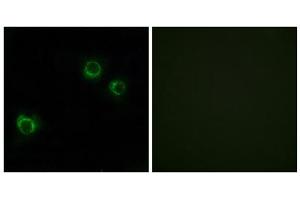 Immunofluorescence analysis of HUVEC cells, using CLDN6 antibody. (Claudin 6 antibody  (Internal Region))