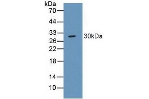 Detection of SCNN1a in Porcine Large Intestine Tissue using Polyclonal Antibody to Amiloride Sensitive Sodium Channel Subunit Alpha (SCNN1a) (SCNN1A antibody  (AA 112-543))