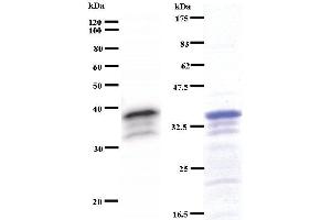 Left: ZNF161 staining. (VEZF1 antibody)