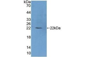 Detection of Recombinant PLCb1, Human using Polyclonal Antibody to Phospholipase C Beta 1 (PLCB1) (Phospholipase C beta 1 antibody  (AA 316-476))