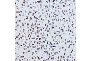 Immunohistochemistry (IHC) image for anti-Histone H2B (acLys12) antibody (ABIN7267731)