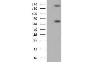 Western Blotting (WB) image for anti-Butyrophilin, Subfamily 1, Member A1 (BTN1A1) antibody (ABIN1496988) (BTN1A1 antibody)