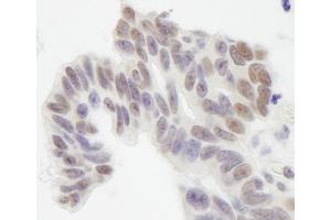 anti-Nonhomologous End-Joining Factor 1 (NHEJ1) (AA 200-250) antibody