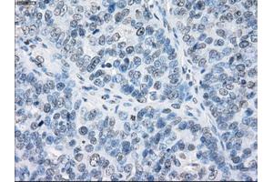 Immunohistochemical staining of paraffin-embedded Kidney tissue using anti-FCGR2A mouse monoclonal antibody.