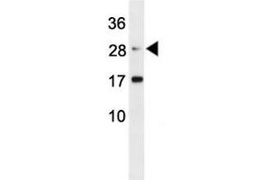 Erythropoietin antibody western blot analysis in mouse L929 lysate (EPO antibody  (AA 20-48))