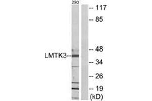 Western blot analysis of extracts from 293 cells, using LMTK3 Antibody. (LMTK3 antibody  (AA 1251-1300))