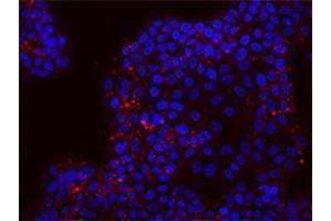 Immunofluorescence (IF) image for anti-CD24 Molecule (CD24) antibody (Alexa Fluor 647) (ABIN2657703) (CD24 antibody  (Alexa Fluor 647))