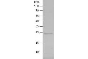 Western Blotting (WB) image for Minichromosome Maintenance Complex Component 3 Associated Protein (MCM3AP) (AA 1771-1980) protein (His tag) (ABIN7282349) (GANP Protein (AA 1771-1980) (His tag))