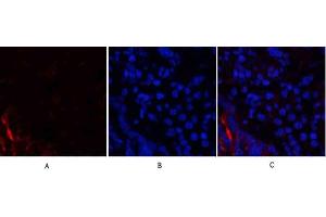 Immunofluorescence analysis of rat lung tissue. (PI3K p85 alpha/gamma antibody)