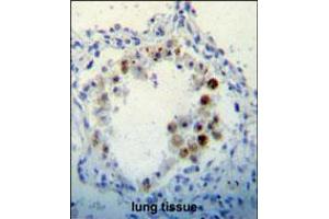 CDKN2B Antibody immunohistochemistry analysis in formalin fixed and paraffin embedded human lung tissue followed by peroxidase conjugation of the secondary antibody and DAB staining.