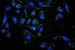 IF analysis of PRKCD using anti-PRKCD antibody (ABIN7601631).