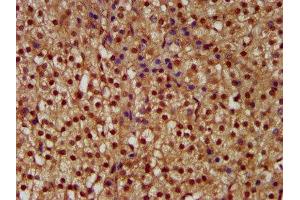 IHC image of ABIN7169088 diluted at 1:300 and staining in paraffin-embedded human adrenal gland tissue performed on a Leica BondTM system. (NEK1 antibody  (AA 626-809))