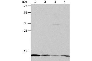 Western Blot analysis of Hela, Jurkat, MCF7 and A431 cell using ATPIF1 Polyclonal Antibody at dilution of 1:1200 (ATPase Inhibitory Factor 1 antibody)