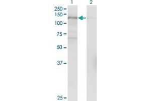 Western Blotting (WB) image for anti-Ubiquitin Specific Peptidase 15 (USP15) (AA 1-235) antibody (ABIN564282)