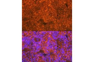 Immunofluorescence analysis of rat spleen using CD3D Rabbit mAb (ABIN7266193) at dilution of 1:100 (40x lens). (CD3D antibody)