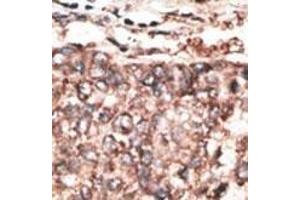 Immunohistochemistry (Paraffin-embedded Sections) (IHC (p)) image for anti-Platelet Derived Growth Factor D (PDGFD) (AA 313-341) antibody (ABIN390196)