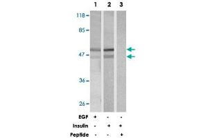 Western blot analysis of extracts from 293 cells using SHC1 polyclonal antibody . (SHC1 antibody)