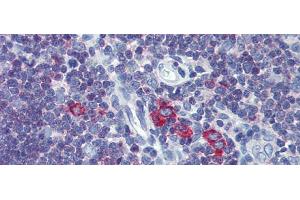 Immunohistochemistry with Human Thymus lysate tissue at an antibody concentration of 5. (Transferrin Receptor 2 antibody  (Middle Region))